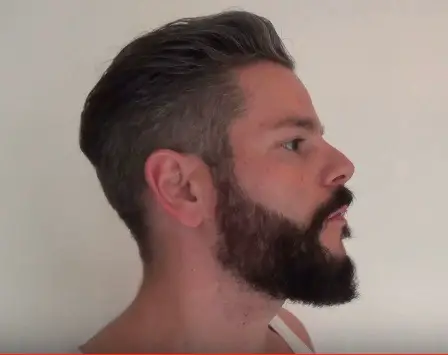 Doppelkinn mit Bart kaschieren